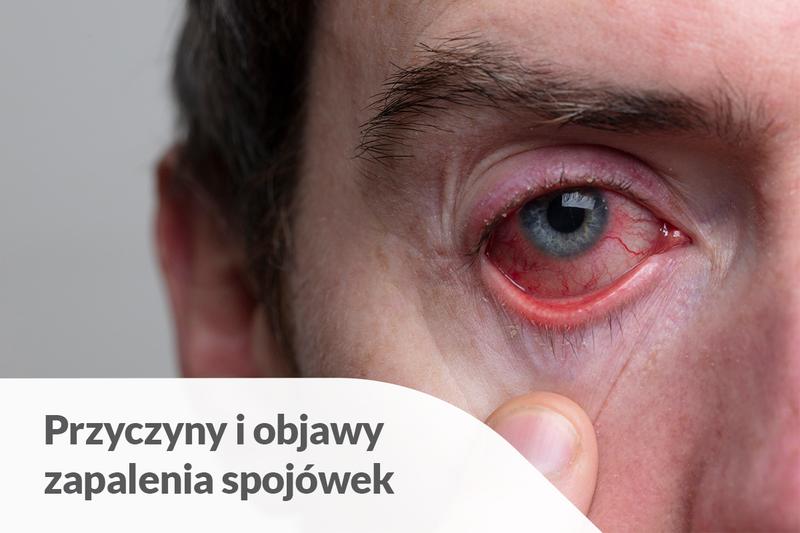 Skutki uboczne antybiotyków u dzieci