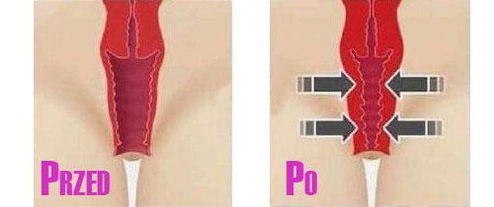 Jak radzić sobie z luźną pochwą po porodzie? Sprawdź nasze porady!