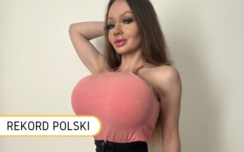 Karmienie piersią z implantami