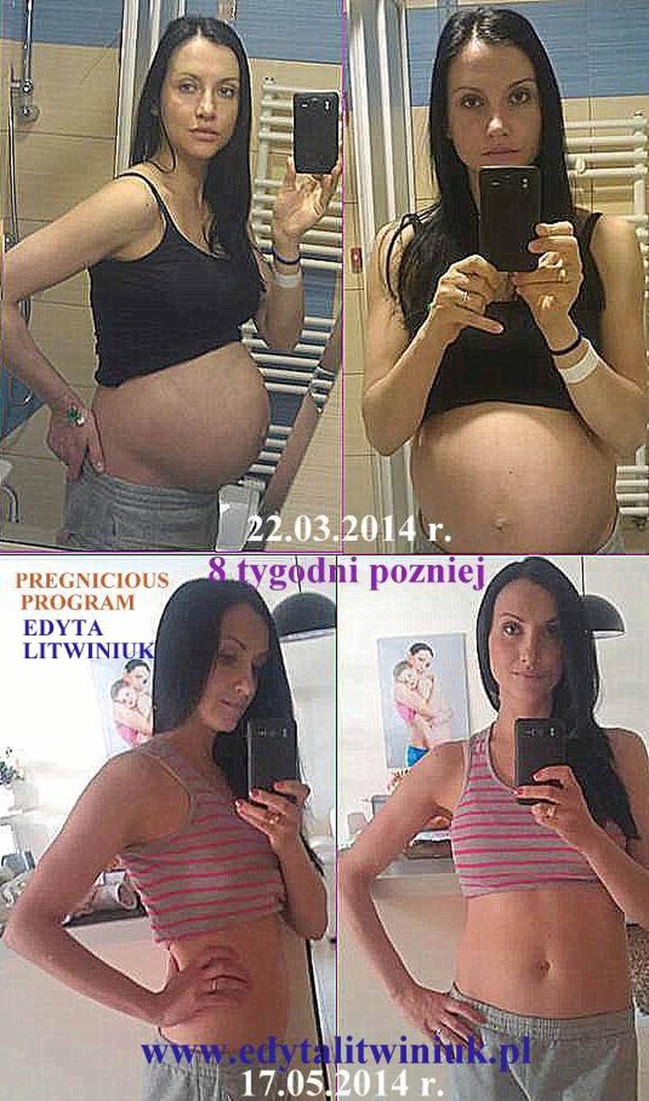 Rehabilitacja i ćwiczenia po porodzie