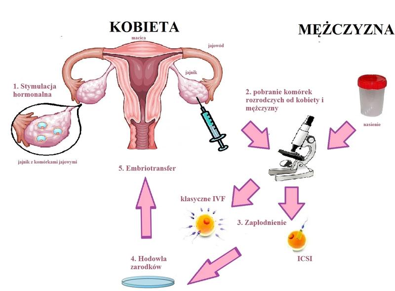 Termin porodu po in vitro