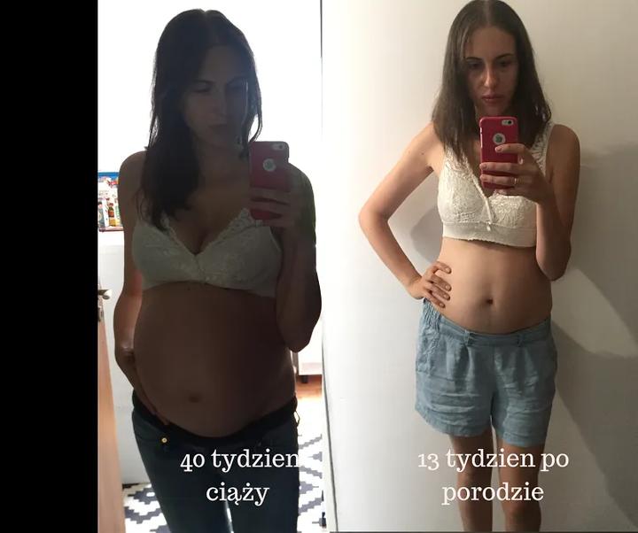 Jak wygląda proces schodzenia się bioder po porodzie?