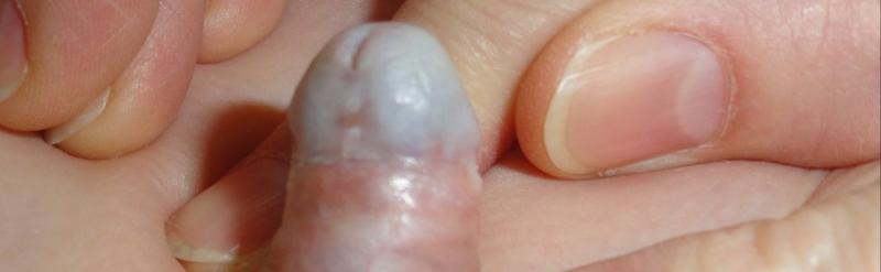 Etyka decyzji rodzicielskich w medycynie