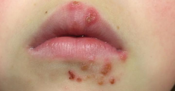 Pielęgnacja skóry dziecka