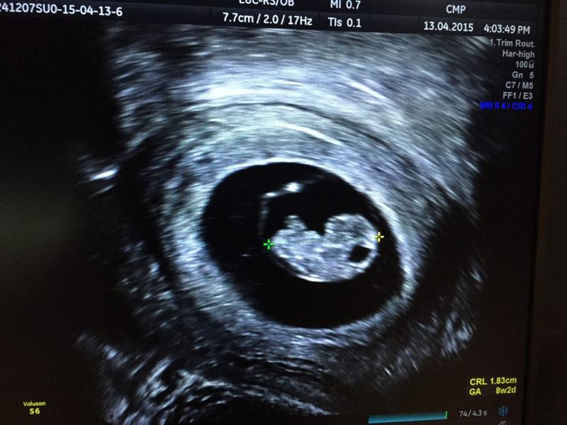 Rozwój płodu w 5 tygodniu