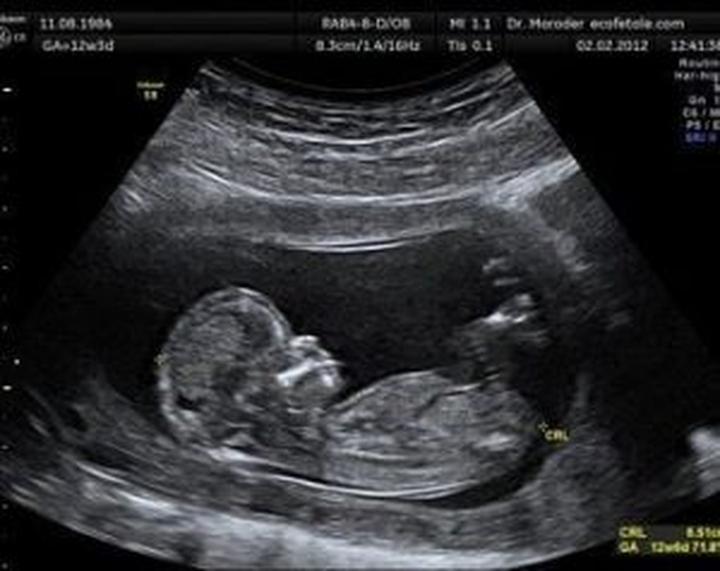 Ultrasonografia w ciąży badania naukowe