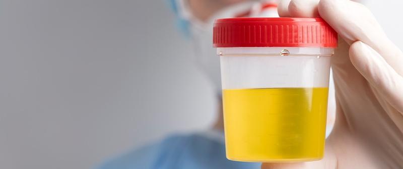 Co oznaczają leukocyty w moczu po porodzie?