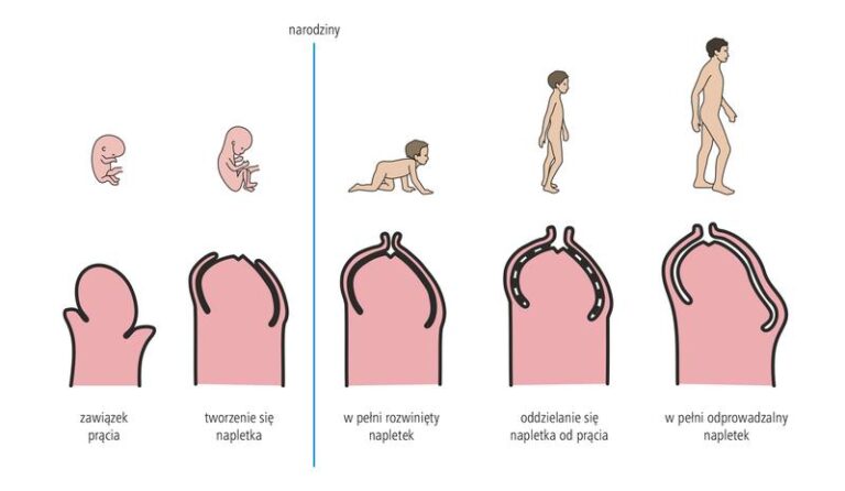 Czy powinno się ściągać dziecku napletek? Co warto wiedzieć?