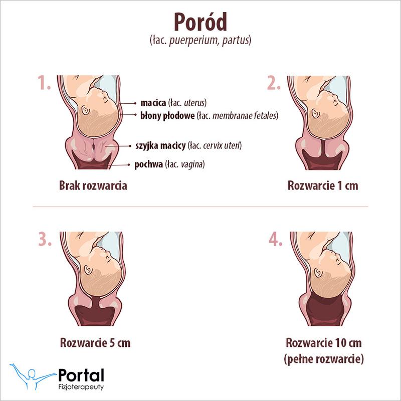 Jakie są doświadczenia mam na forum dotyczące porodu naturalnego po cesarskim cięciu?