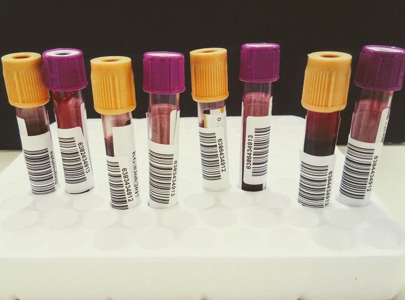 Bezpieczne karmienie piersią przy HIV