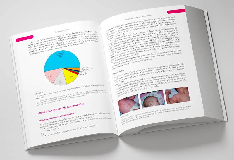 Ciąża bez objawów