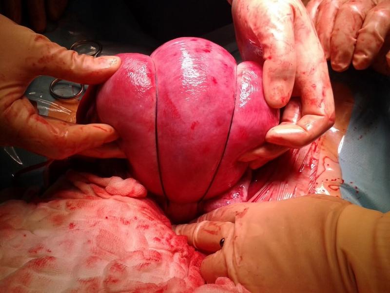 Karmienie piersią a krwiodawstwo