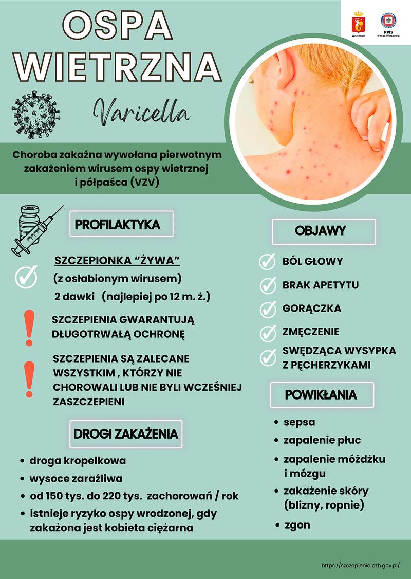 Laktacja podczas ospy wietrznej