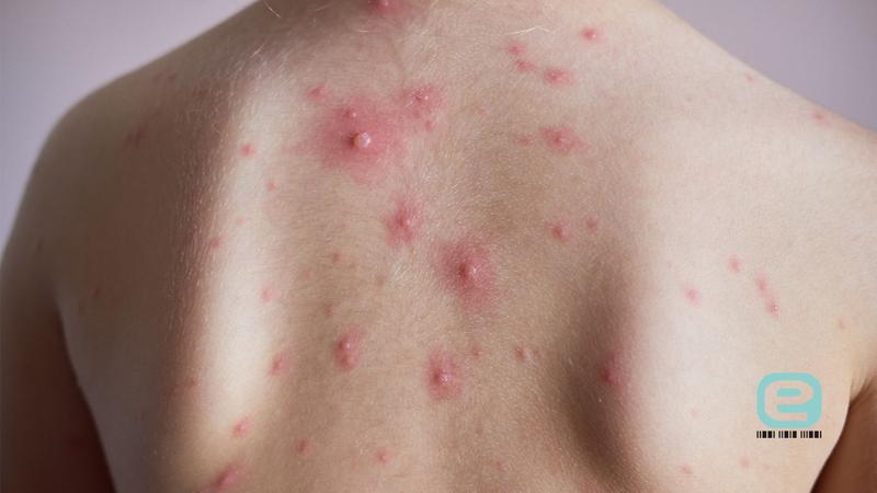 Mleko matki i zdrowie dziecka