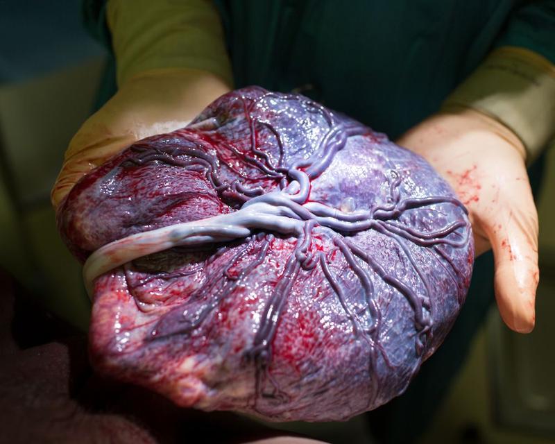 Oddawanie krwi po porodzie