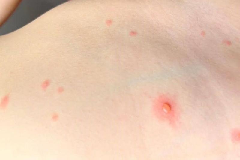 Zalecenia zdrowotne dla karmiących mam