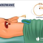 Cewnikowanie po porodzie – co warto wiedzieć dla komfortu matki?