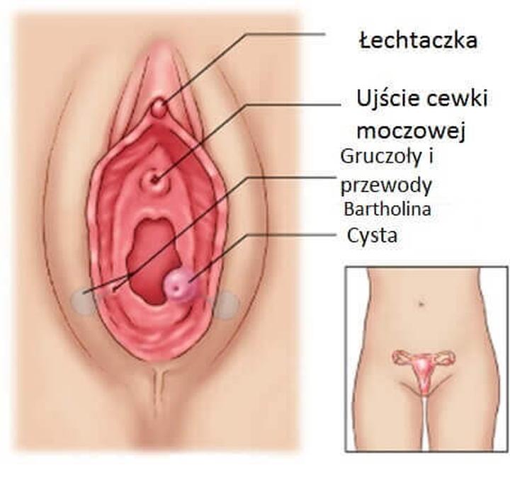 Co oznacza guzek w pochwie po porodzie? Przewodnik dla młodych mam