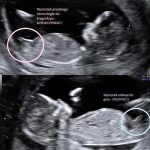 Czy to prawda, że słodkie w ciąży może wskazywać na płeć dziecka?