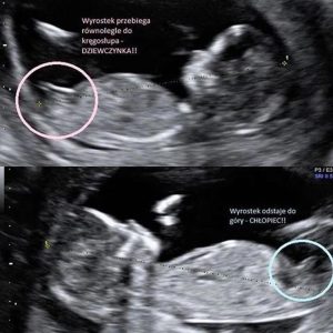 Czy to prawda, że słodkie w ciąży może wskazywać na płeć dziecka?