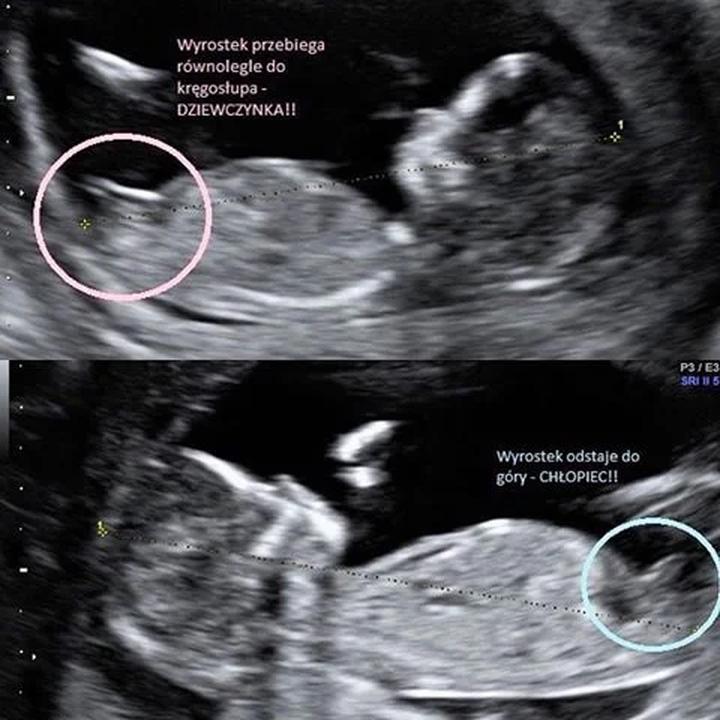 Czy to prawda, że słodkie w ciąży może wskazywać na płeć dziecka?