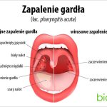 Jak radzić sobie z bólem gardła podczas karmienia piersią? Domowe sposoby na ulgę