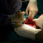 Nacinanie krocza podczas porodu – czy to rzeczywiście konieczność?