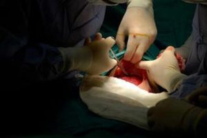 Nacinanie krocza podczas porodu – czy to rzeczywiście konieczność?