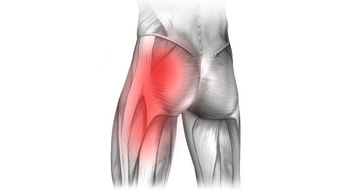 Ból pośladka po porodzie