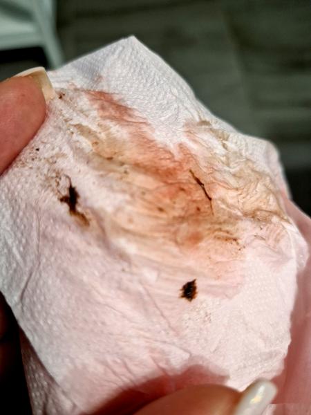 Brązowe plamienie po porodzie