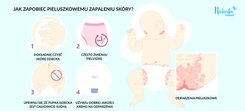 Metody leczenia nadżerki