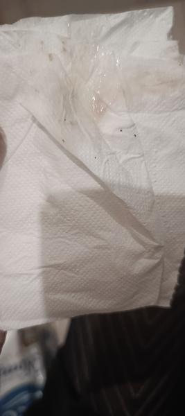 Objawy nieprawidłowości hormonalnych