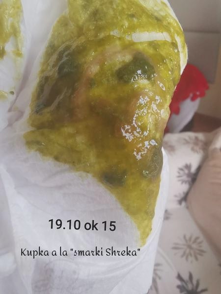 Dlaczego śmierdzące kupki u niemowląt karmionych piersią nie powinny cię niepokoić?