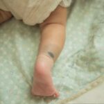 Dlaczego u noworodka mogą pojawić się siniaki po porodzie?