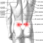 Jak radzić sobie z bólem pośladka po porodzie – praktyczne porady dla świeżo upieczonych mam