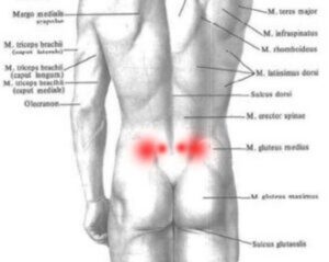Jak radzić sobie z bólem pośladka po porodzie – praktyczne porady dla świeżo upieczonych mam