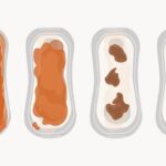 Żółte upławy po porodzie – co może być ich przyczyną?