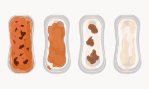 Żółte upławy po porodzie – co może być ich przyczyną?