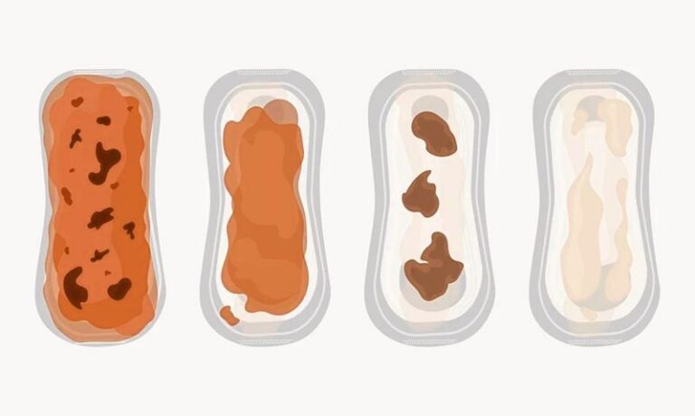 Żółte upławy po porodzie – co może być ich przyczyną?