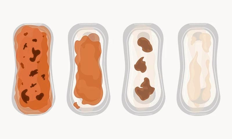 Żółte upławy po porodzie – co może być ich przyczyną?